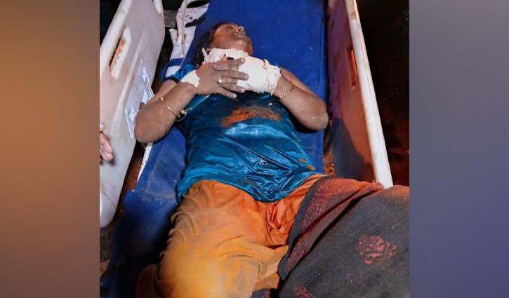 নারীকে ছুরিকাঘাত, জড়িতদের ধরতে পুলিশের অভিযান - Chief TV