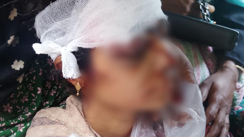 বদলগাছীতে ঘরে ঢুকে গৃহবধূকে কুপিয়ে জখম, জনমনে আতঙ্ক