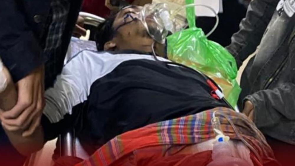 নওগাঁয় পূর্ববিরোধে পলিটেকনিক শিক্ষার্থীকে কুপিয়ে জখম - Chief TV
