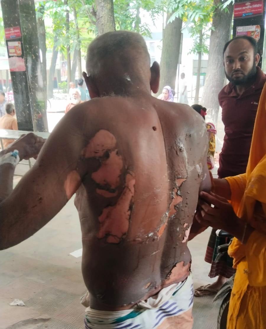 সৈয়দপুরে আগুনে ঝলসানো বৃদ্ধ উদ্ধার নাশকতার ঘটনায় পাল্টাপাল্টি অভিযোগ  -Chief TV